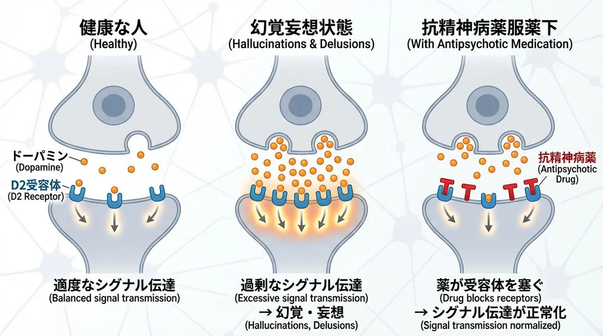 Neural synapse and dopamine diagram for schizophrenia